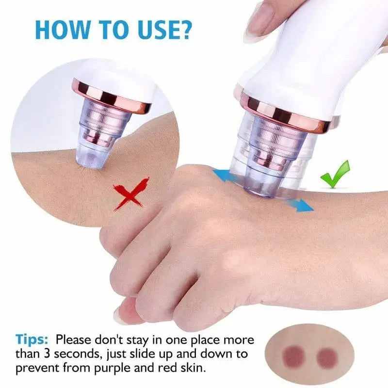 5 In 1 Blackheads Removing Device Electric Derma Suction Machine Duad (ض)